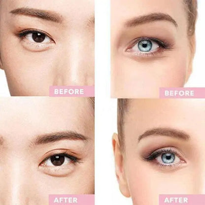 Instant Eye Lift